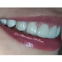 دندانپزشکی زیبایی و لمینت|خدمات آرایشگری و زیبایی|تهران, سلیمانی|دیوار