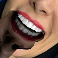 خدمات لمینیت و کامپوزیت دندان و پروتزهای دندانی|خدمات آرایشگری و زیبایی|کرج, گلشهر|دیوار