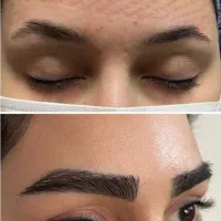 کاشت مو و ریش و ابرو|خدمات آرایشگری و زیبایی|یاسوج, |دیوار