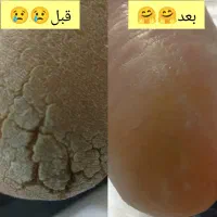 پدیکور درمانی آقایان و بانوان|خدمات آرایشگری و زیبایی|قم, دورشهر|دیوار