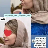 پنکک|آرایشی، بهداشتی، درمانی|ملکآباد, |دیوار