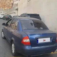 تیباابی کاربنی ۱۳۹۶|خودرو سواری و وانت|تهران, جماران (نیاوران)|دیوار