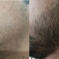 ریشت رو قوی‌تر از همیشه کن