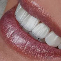 دندانپزشکی  تخصصی ترین مرکز ایمپلنت و جراحی|خدمات آرایشگری و زیبایی|ورزقان, |دیوار