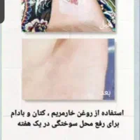 روغن درمانی|خوردنی و آشامیدنی|اسلامشهر, ده عباس|دیوار