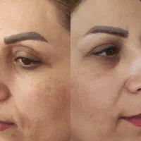 قویترین ضد لک دنیا/برای همه خانمهای جذاب|آرایشی، بهداشتی، درمانی|تهران, بوستان چیتگر|دیوار