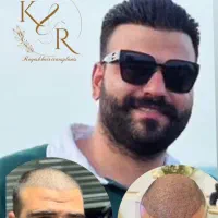 کلینیک تخصصی کاشت مو و ابرو رویش