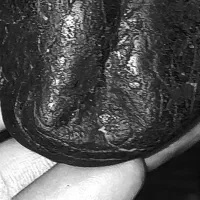 شهاب سنگ الماسی|کلکسیون اشیاء عتیقه|ماسال, |دیوار