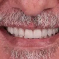 جشنواره پاییز(دندان مصنوعی)اقساط بدون پیش پرداخت|خدمات آرایشگری و زیبایی|تهران, فلسطین (میدان انقلاب)|دیوار