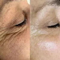 کرم بیوممتیک اصل