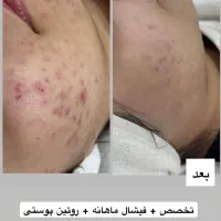 فشیال تخصصی با تخفیف استثنایی در مطب آقا و خانم