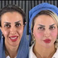 تزریق ژل لب و گونه و چانه.. (جشنواره)درمطب فقط500ت|خدمات آرایشگری و زیبایی|اصفهان, باغ زیار|دیوار