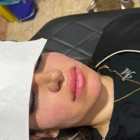 ژل بوتاکس|خدمات آرایشگری و زیبایی|دورود, |دیوار