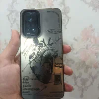 موبایل note11