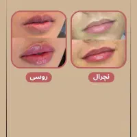 اپراتور ژل و بوتاکس