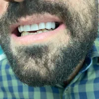 منشی خانم جهت کار در دنداسازی