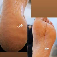 کاشت ناخن ، اسپا ،پارافین تراپی و آموزش همه موارد|خدمات آرایشگری و زیبایی|شیراز, معالی‌آباد|دیوار