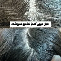 اسکراب اسکالپ تخصصی