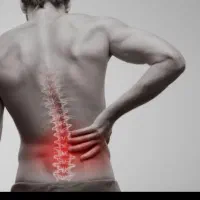 راهنمای عمل تنگی کانال نخاعی