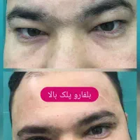 مرکز زیبایی لیزا|خدمات آرایشگری و زیبایی|کرج, شهرک اوج|دیوار