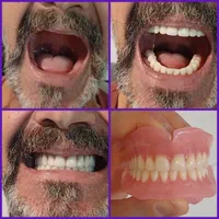 دندانسازی دندان مصنوعی|خدمات آرایشگری و زیبایی|شیراز, شهرک گلستان|دیوار