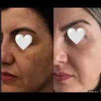 کرم شب معجزه و vip