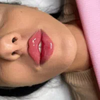فیلر ژل بوتاکس آنزیم مزو زاویه سازی
