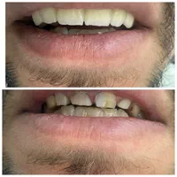 خدمات دندانپزشکی