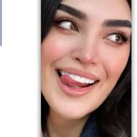 کامپوزیت دندان فکی فقط ۱۰ میلیون تومان