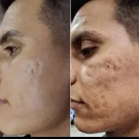 سرم سه گانه هوشمند جوانساز وروشن کننده