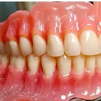 خدمات دندانپزشکی ودندانسازی درکنگاور باکمترین قیمت