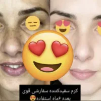 کرم سفید کننده قوی کره ایی صورت طلاسفید