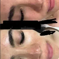 فشیال تخصصی و روشن سازی دایمی