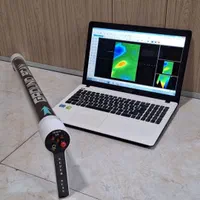 اسکنر سه بعدی تصویری برای تشخیص حفره