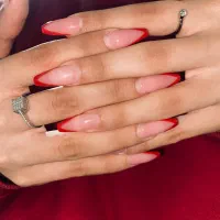 کاشت ترمیم لمینت...