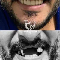 دندان سازی،مصنوعی،دندان متحرک،دندانسازی|خدمات آرایشگری و زیبایی|ارومیه, |دیوار