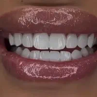 دندان مصنوعی تحویل ۵ساعته(شهر محلات)کامپوزیت دندان|خدمات آرایشگری و زیبایی|اراک, |دیوار