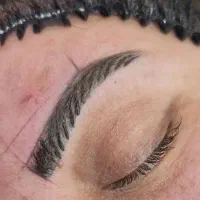 میکروبلیدینگ