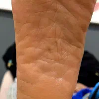 پدیکور درمانی و تخصصی پا بندرعباس|خدمات آرایشگری و زیبایی|بندرعباس, |دیوار