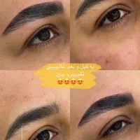 لیفت و اصلاح ابرو تخصصی فقط ۵۰۰