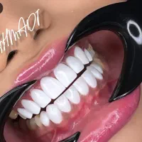 ایمپلنت و کامپوزیت از 8 تومن