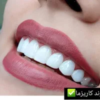 کامپوزیت دندان، روکش، دندانپزشکی تخصصی صدف تهرانسر|خدمات آرایشگری و زیبایی|تهران, تهرانسر مرکزی|دیوار