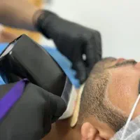 نیازمند اوپراتور لیزر آقا