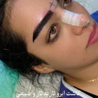 کاشت ابرو دائمی بدون بخیه بدون برش با خواب طبیعی|خدمات آرایشگری و زیبایی|تبریز, |دیوار