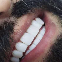 ارائه خدمات زیبایی و درمانی دندانپزشکی|خدمات آرایشگری و زیبایی|کرمانشاه, |دیوار