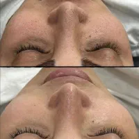 پاکسازی پوست فیشال پوست فیشیال پوست|خدمات آرایشگری و زیبایی|تهران, مجیدیه|دیوار