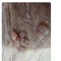 حذف 3روزه