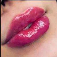 ژل و بوتاکس