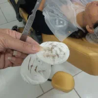 درماپیلینگ