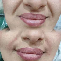 مرکززیبایی و لیزر آکو|خدمات آرایشگری و زیبایی|اندیمشک, |دیوار